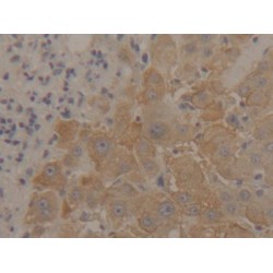 Enolase, Non Neuronal (NNE) Antibody