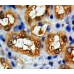 Enolase, Non Neuronal (NNE) Antibody