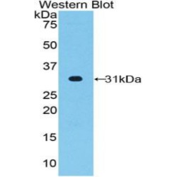 Alpha-(1,3)-Fucosyltransferase 4 (FUT4) Antibody