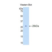 Western blot analysis of recombinant Human IDS.