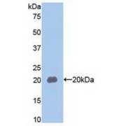 Western blot analysis of recombinant Human MUC5AC.