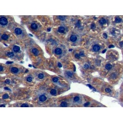 Oxidosqualene Cyclase (OSC) Antibody