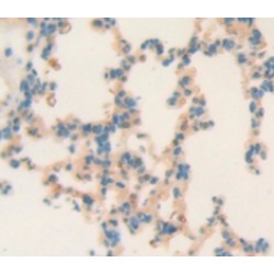 Progesterone Receptor (PGR) Antibody