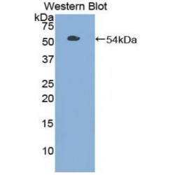 Toll Like Receptor 3 (TLR3) Antibody