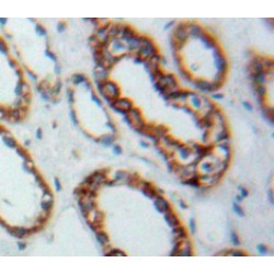 Toll Like Receptor 3 (TLR3) Antibody