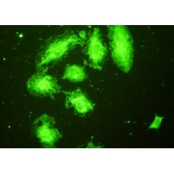 Toll Like Receptor 5 (TLR5) Antibody