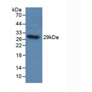 Western blot analysis of recombinant Human TLR5.