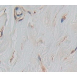 Toll Like Receptor 5 (TLR5) Antibody