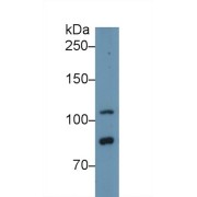 Western blot analysis of Human HeLa cell lysate, using Human TLR5 Antibody (1 µg/ml) and HRP-conjugated Goat Anti-Rabbit antibody (<a href="https://www.abbexa.com/index.php?route=product/search&amp;search=abx400043" target="_blank">abx400043</a>, 0.2 µg/ml).