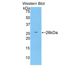 Toll Like Receptor 5 (TLR5) Antibody