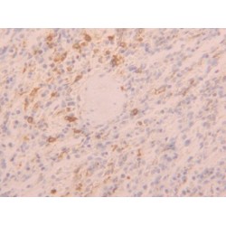 Toll Like Receptor 5 (TLR5) Antibody