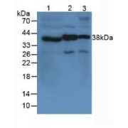 Western blot analysis of (1) Human Blood platelet Cells, (2) Mouse Brain Tissue and (3) Mouse Spinal Cord Tissue.