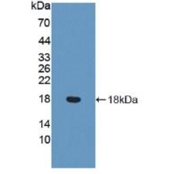 Von Willebrand Factor (vWF) Antibody