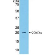 Western blot analysis of recombinant Mouse vWF.