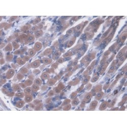 Von Willebrand Factor (vWF) Antibody