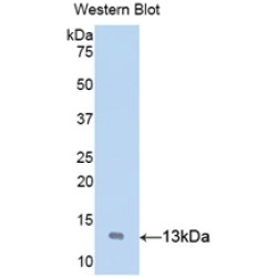 Von Willebrand Factor (vWF) Antibody