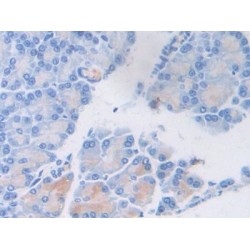 Von Willebrand Factor (vWF) Antibody