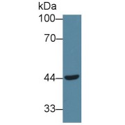 Western blot analysis of Human Jurkat cell lysate.