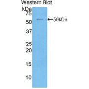 Western blot analysis of the recombinant protein.