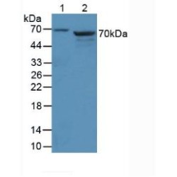 Muellerian-Inhibiting Factor (AMH) Antibody