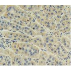 Muellerian-Inhibiting Factor (AMH) Antibody