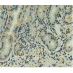 Muellerian-Inhibiting Factor (AMH) Antibody