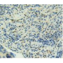 Muellerian-Inhibiting Factor (AMH) Antibody