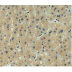 Muellerian-Inhibiting Factor (AMH) Antibody