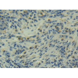 Muellerian-Inhibiting Factor (AMH) Antibody