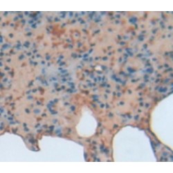 B-Cell CLL/Lymphoma 3 (Bcl3) Antibody