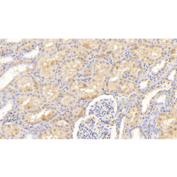 Coagulation Factor XII (F12) Antibody