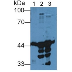 Creatine Kinase B-Type (CKB) Antibody