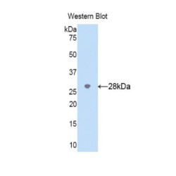 Cytochrome P450 2D6 (CYP2D6) Antibody