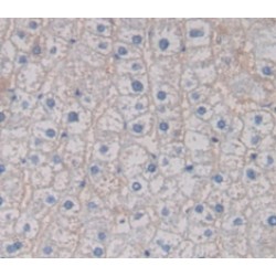 Cytochrome P450 2D6 (CYP2D6) Antibody