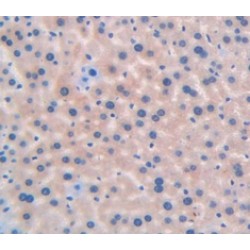 Cytochrome P450 2E1 (CYP2E1) Antibody