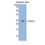 Western blot analysis of the recombinant protein.