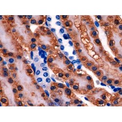 Glutathione Synthetase (GSS) Antibody