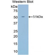 Western blot analysis of recombinant Human IFNa21 Protein (with N-terminal His and GST tags).