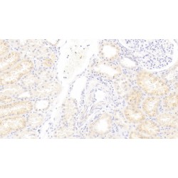 Interferon Alpha 21 (IFNa21) Antibody