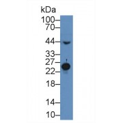 Western blot analysis of Mouse Serum, using Mouse MBL Antibody (2 µg/ml) and HRP-conjugated Goat Anti-Rabbit antibody (<a href="https://www.abbexa.com/index.php?route=product/search&amp;search=abx400043" target="_blank">abx400043</a>, 0.2 µg/ml).
