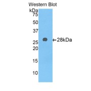 Western blot analysis of the recombinant protein.