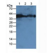 Western blot analysis of (1) Human Blood Cells, (2) Rat Blood Cells and (3) Mouse Blood Cells.