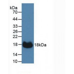 Carbonic Anhydrase XII (CA12) Antibody