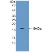 Western blot analysis of recombinant Rat CA12.