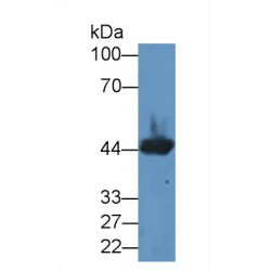 Creatine Kinase, Muscle (CKM) Antibody