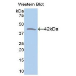 Creatine Kinase, Muscle (CKM) Antibody