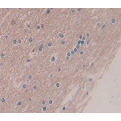 Creatine Kinase, Muscle (CKM) Antibody