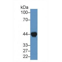 Creatine Kinase, Muscle (CKM) Antibody