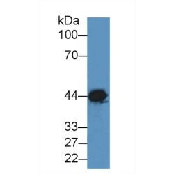 Creatine Kinase, Muscle (CKM) Antibody