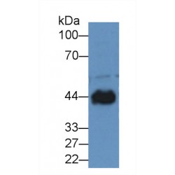 Creatine Kinase, Muscle (CKM) Antibody